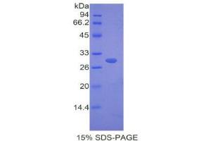 SDS-PAGE (SDS) image for Fibulin 4 (FBLN4) (AA 182-431) protein (His tag) (ABIN1877704)