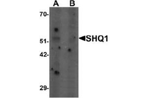 Western blot analysis of SHQ1 in human heart tissue lysate with SHQ1 Antibody  at 1 ug/mL in (A) the absence and (B) the presence of blocking peptide. (SHQ1 Antikörper  (N-Term))