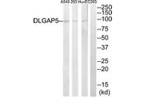 Western blot analysis of extracts from A549/293/HuvEc cells, using DLGAP5 Antibody.