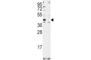 Western Blotting (WB) image for anti-Aldehyde Dehydrogenase 1 Family, Member A3 (ALDH1A3) antibody (ABIN3003524) (ALDH1A3 Antikörper)