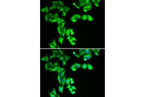 Immunofluorescence analysis of HeLa cells using STRN3 antibody (ABIN6129134, ABIN6148646, ABIN6148648 and ABIN6222490). (STRN3 Antikörper  (AA 200-460))