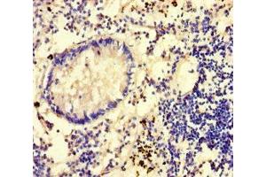 Immunohistochemistry of paraffin-embedded human appendix tissue using ABIN7149462 at dilution of 1:100 (GLCE Antikörper  (AA 29-617))