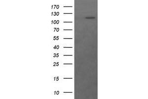 Image no. 1 for anti-RAS P21 Protein Activator (GTPase Activating Protein) 1 (RASA1) antibody (ABIN1500607)