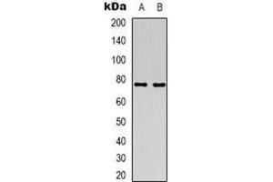 Western blot analysis of ACSS1 expression in HT29 (A), Jurkat (B) whole cell lysates. (ACSS1 Antikörper  (C-Term))