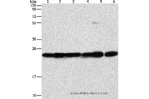 Western blot analysis of Mouse liver and brain tissue, 293T, A549, A431 and PC3 cell, using SIGMAR1 Polyclonal Antibody at dilution of 1:310 (SIGMAR1 Antikörper)