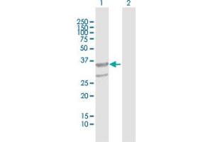 Western Blot analysis of ABHD11 expression in transfected 293T cell line by ABHD11 MaxPab polyclonal antibody. (ABHD11 Antikörper  (AA 1-315))