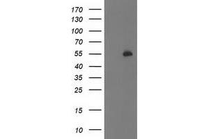 Western Blotting (WB) image for anti-Pre-B-Cell Leukemia Homeobox Protein 1 (PBX1) antibody (ABIN1500045) (PBX1 Antikörper)
