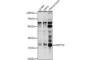 Western blot analysis of extracts of various cell lines, using OR2T10 antibody (ABIN7269088) at 1:1000 dilution. (OR2T10 Antikörper  (AA 1-100))