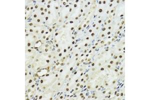 Immunohistochemistry of paraffin-embedded mouse kidney using Phospho-Histone H3-S10/T11 antibody (ABIN7267688) at dilution of 1:100 (40x lens).
