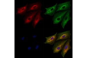 ABIN6264233 and ABIN6279658 staining  cells by IF/ICC.