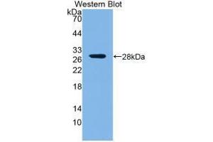 Western blot analysis of the recombinant protein. (ROR1 Antikörper  (AA 470-707))