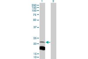 Western Blot analysis of IGLL1 expression in transfected 293T cell line by IGLL1 MaxPab polyclonal antibody. (IGLL1 Antikörper  (AA 1-213))