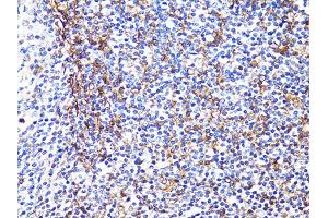 Immunohistochemistry of paraffin-embedded human tonsil using S100A10 antibody (ABIN5971035) at dilution of 1/100 (40x lens).