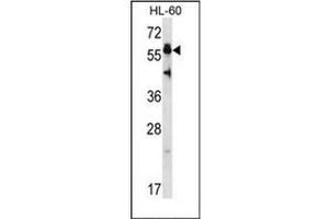 Western blot analysis of Heat shock factor 4 / HSF4 (N-term) Antibody (N-term) in HL-60 cell line lysates (35ug/lane).