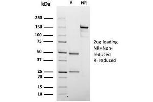 SDS-PAGE Analysis Purified Chromogranin A Mouse Recombinant Monoclonal Ab (rCHGA/798). (Rekombinanter Chromogranin A Antikörper)