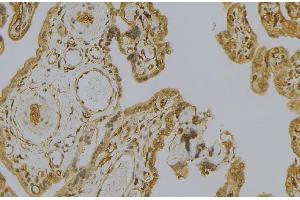 ABIN6279235 at 1/100 staining Mouse placenta tissue by IHC-P.