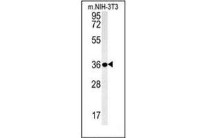 Western Blotting (WB) image for anti-Lectin, Galactoside-Binding, Soluble, 9B (LGALS9B) (AA 167-196), (Middle Region) antibody (ABIN953164)