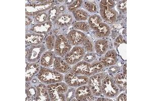 Immunohistochemical staining of human kidney with ARHGAP11A polyclonal antibody  shows moderate cytoplasmic and membranous positivity in tubular cells. (ARHGAP11A Antikörper)