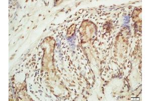 Formalin-fixed and paraffin embedded mouse intestine labeled with Rabbit Anti-RPA2(Thr21) Polyclonal Antibody, Unconjugated (ABIN713351) at 1:200 followed by conjugation to the secondary antibody and DAB staining (RPA2 Antikörper  (pThr21))