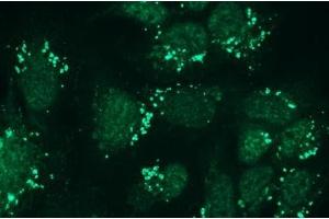 Immunocytochemistry (ICC) image for anti-Nephrosis 1, Congenital, Finnish Type (Nephrin) (NPHS1) antibody (ABIN870330) (Nephrin Antikörper)