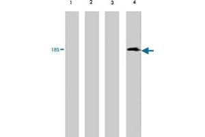 Western blot analysis of extract from red sea bream (lane 1) , carp (lane 2) , mummichog (lane 3) and medaka (lane 4) , using Vitellogenin monoclonal antibody, clone 3C1  . (Vitellogenin 2 Antikörper)