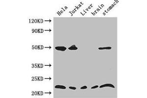 Western Blot Positive WB detected in: Hela whole cell lysate, Jurkat whole cell lysate, Mouse liver tissue, Mouse brain tissue, Mouse stomach tissue All lanes: COMMD1 antibody at 3. (COMMD1 Antikörper  (AA 2-190))