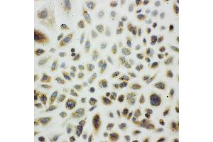 Immunohistochemistry (IHC) image for anti-Heat Shock 10kDa Protein 1 (Chaperonin 10) (HSPE1) (AA 81-102), (C-Term) antibody (ABIN3044176)