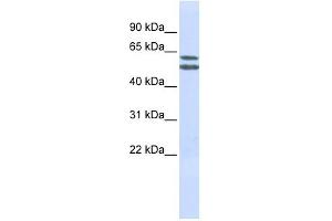 PIGQ antibody used at 1 ug/ml to detect target protein. (PIGQ Antikörper  (N-Term))