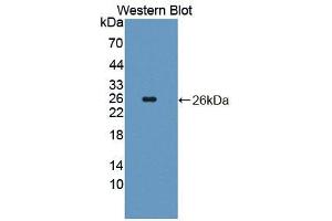 Western blot analysis of the recombinant protein. (Coronin 1a Antikörper  (AA 1-204))