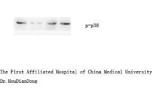 Western Blot (WB) analysis: Please contact us for more details.