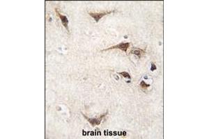 Formalin-fixed and paraffin-embedded human brain tissue reacted with SARS antibody (C-term) (ABIN392296 and ABIN2841952) , which was peroxidase-conjugated to the secondary antibody, followed by DAB staining. (Seryl-tRNA Synthetase (SARS) (AA 394-422), (C-Term) Antikörper)