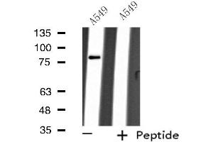 Western blot analysis of extracts from A549 cells, using ARHGEF16 antibody. (ARHGEF16 Antikörper  (Internal Region))