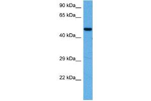 Host:  Rabbit  Target Name:  MEF2A  Sample Tissue:  Mouse Heart  Antibody Dilution:  1ug/ml (MEF2A Antikörper  (N-Term))