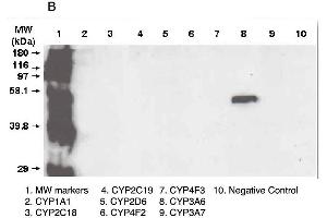 A. (CYP3A5 Antikörper  (C-Term))