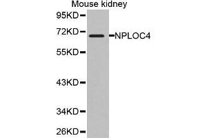 Western Blotting (WB) image for anti-Nuclear Protein Localization 4 Homolog (NPLOC4) (AA 1-270) antibody (ABIN1681086) (NPLOC4 Antikörper  (AA 1-270))