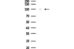 Western blot analysis of lysates from COLO205 cells(UV,30 min treatment), using UHRF1 Antibody at 1/1000 dilution.