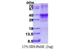 Image no. 1 for SIX Homeobox 1 (SIX1) protein (His tag) (ABIN1098684)