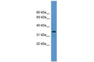Image no. 1 for anti-Arginase, Type II (ARG2) (AA 71-120) antibody (ABIN6746383)
