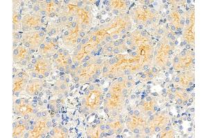 ABIN6258497 and ABIN6274436 at 1/100 staining Rat kidney tissue by IHC-P. (COQ8A Antikörper)