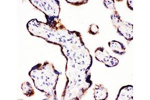IHC-P: CYP11A1 antibody testing of human placenta tissue (CYP11A1 Antikörper  (C-Term))