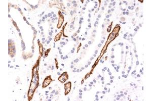 Formalin-fixed, paraffin-embedded human Kidney Transplant stained with Complement 4d Monoclonal Antibody (SPM545).