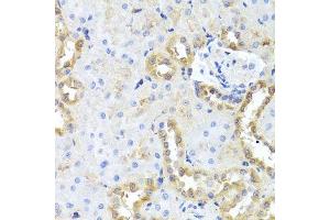 Immunohistochemistry of paraffin-embedded rat kidney using CGB7 antibody. (CGB7 Antikörper  (AA 21-165))