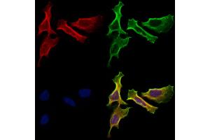 ABIN7094795 and ABIN7098846 staining Hela cells by IF/ICC. (HHIP Antikörper  (C-Term))