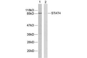 Western blot analysis of extracts from HeLa cells using STAT4 (Ab-693) antibody (E021047). (STAT4 Antikörper)
