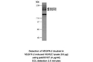 Image no. 1 for anti-VEGF Receptor 2 (VEGFR2) (AA 1200-1300), (Internal Region) antibody (ABIN363476) (VEGFR2/CD309 Antikörper  (Internal Region))
