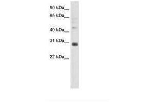 Image no. 1 for anti-Distal-Less Homeobox 5 (DLX5) (C-Term) antibody (ABIN202168) (DLX5 Antikörper  (C-Term))