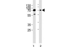 Western blot analysis of lysate from human 1) HeLa, and 2) Jurkat cell line using PAK3 antibody at 1:1000. (PAK3 Antikörper  (AA 124-152))