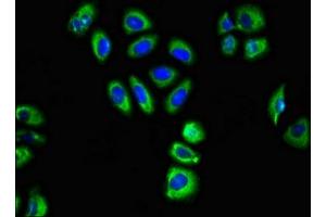 Immunofluorescent analysis of A549 cells using ABIN7153479 at dilution of 1:100 and Alexa Fluor 488-congugated AffiniPure Goat Anti-Rabbit IgG(H+L) (GABRA2 Antikörper  (AA 29-251))