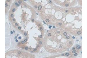 Detection of IDE in Human Kidney Tissue using Polyclonal Antibody to Insulin Degrading Enzyme (IDE) (IDE Antikörper  (AA 753-973))