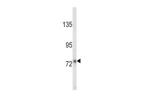 Western blot analysis of LTF Antibody (ABIN652643 and ABIN2842432) in MDA-M cell line lysates (35 μg/lane). (Lactoferrin Antikörper)